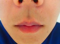 �P�H �E�� AFTER