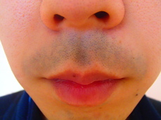 �P�H �E�� BEFORE